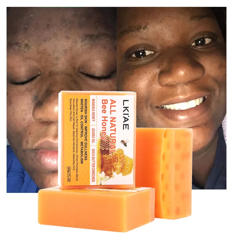 Beauty 7 Days Whitening Manuka Honey Shea Butter Exfoliating Handmade Soap Toilet Bath Whitening Soap Home Use