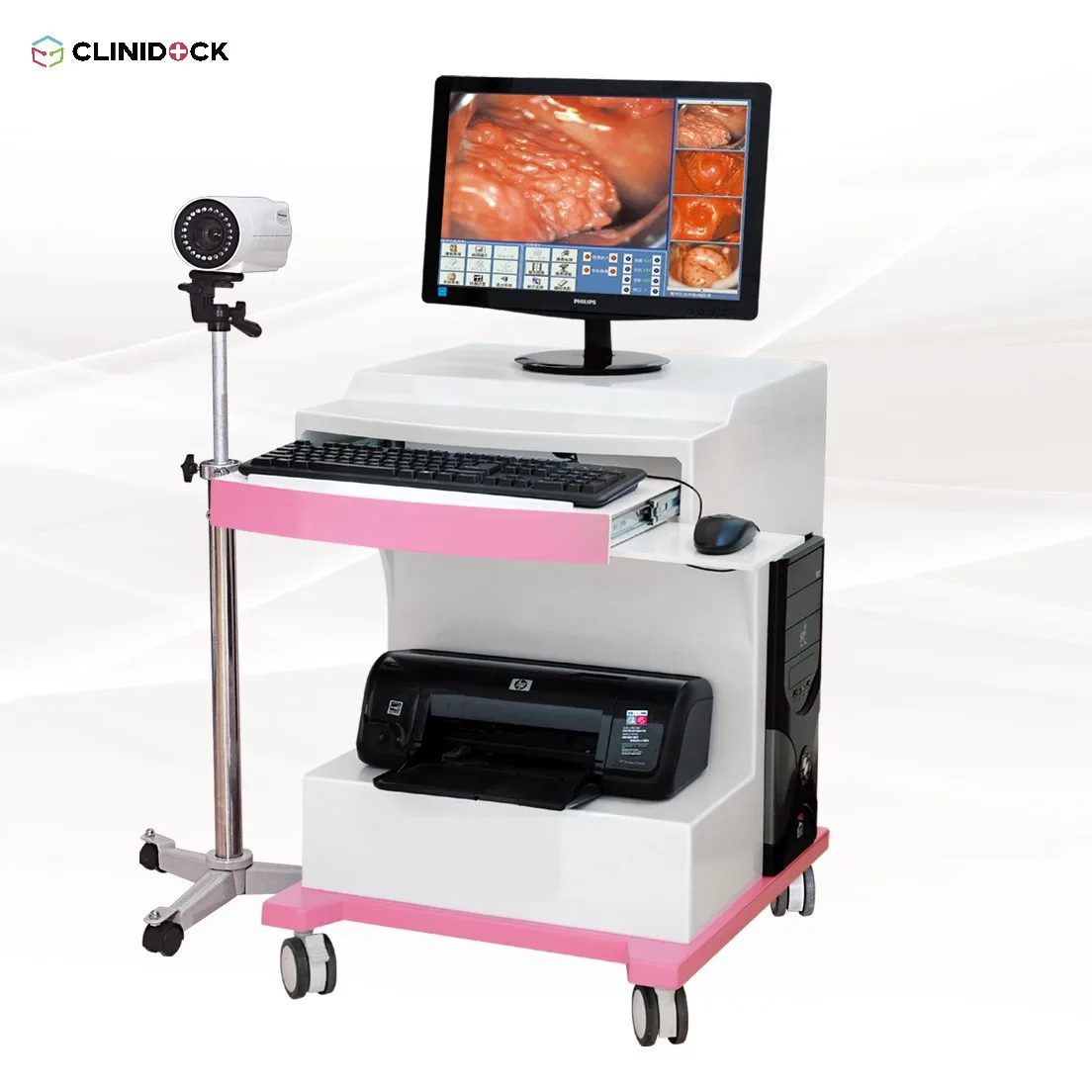 High end Portable Digital Electronic Colposcope, video colposcope for vagina CD-GJ-A8000A