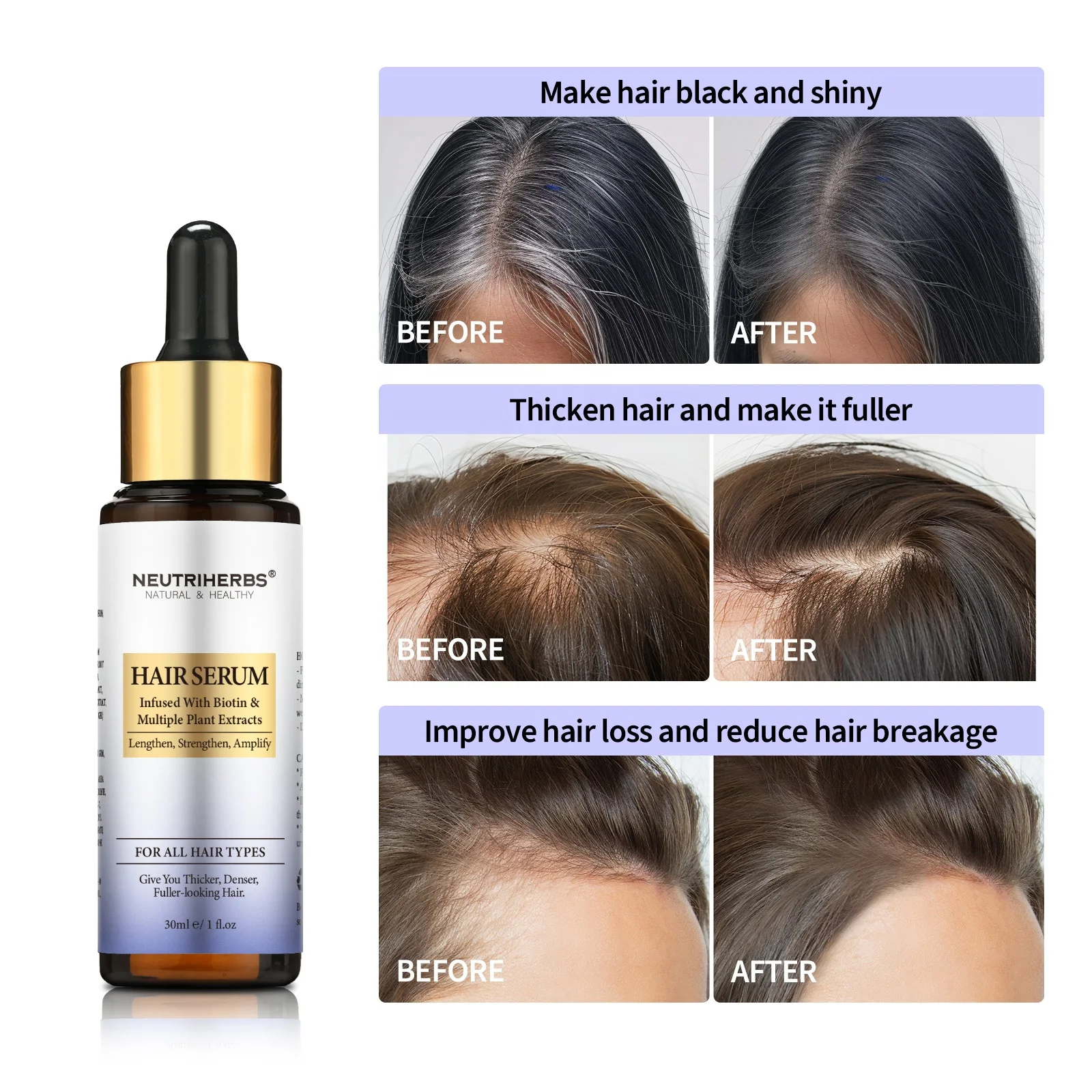 Natural hair regrowth serum vegan hair loss treatments serum for hair growth