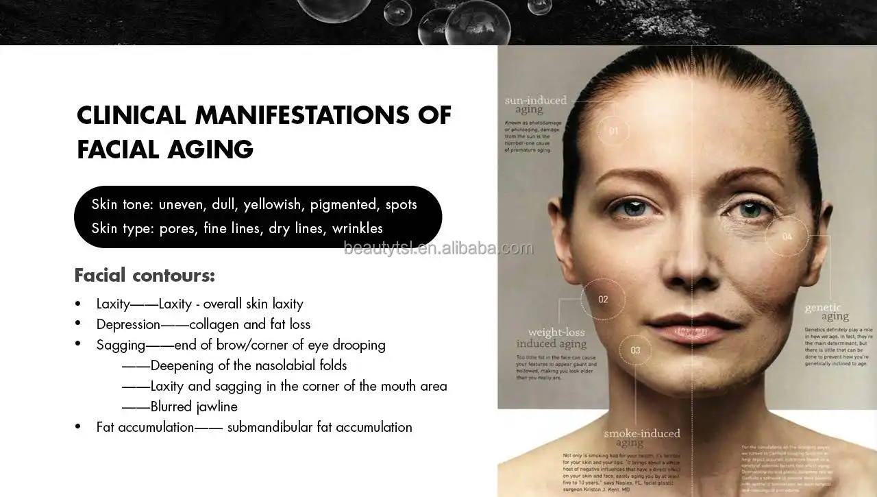 FU4.5-9SC ultramatrix rf 7