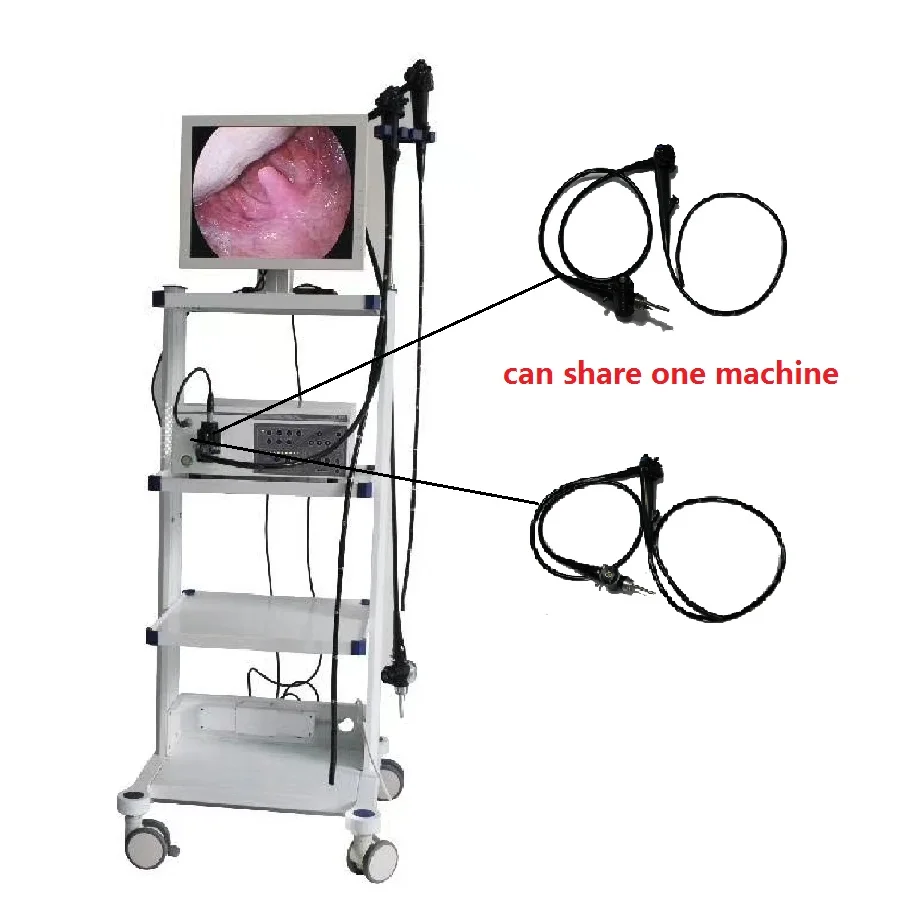 
Factory Price Electronic Endoscope Gastroscope &Colonoscope And Laparoscope In One Set 