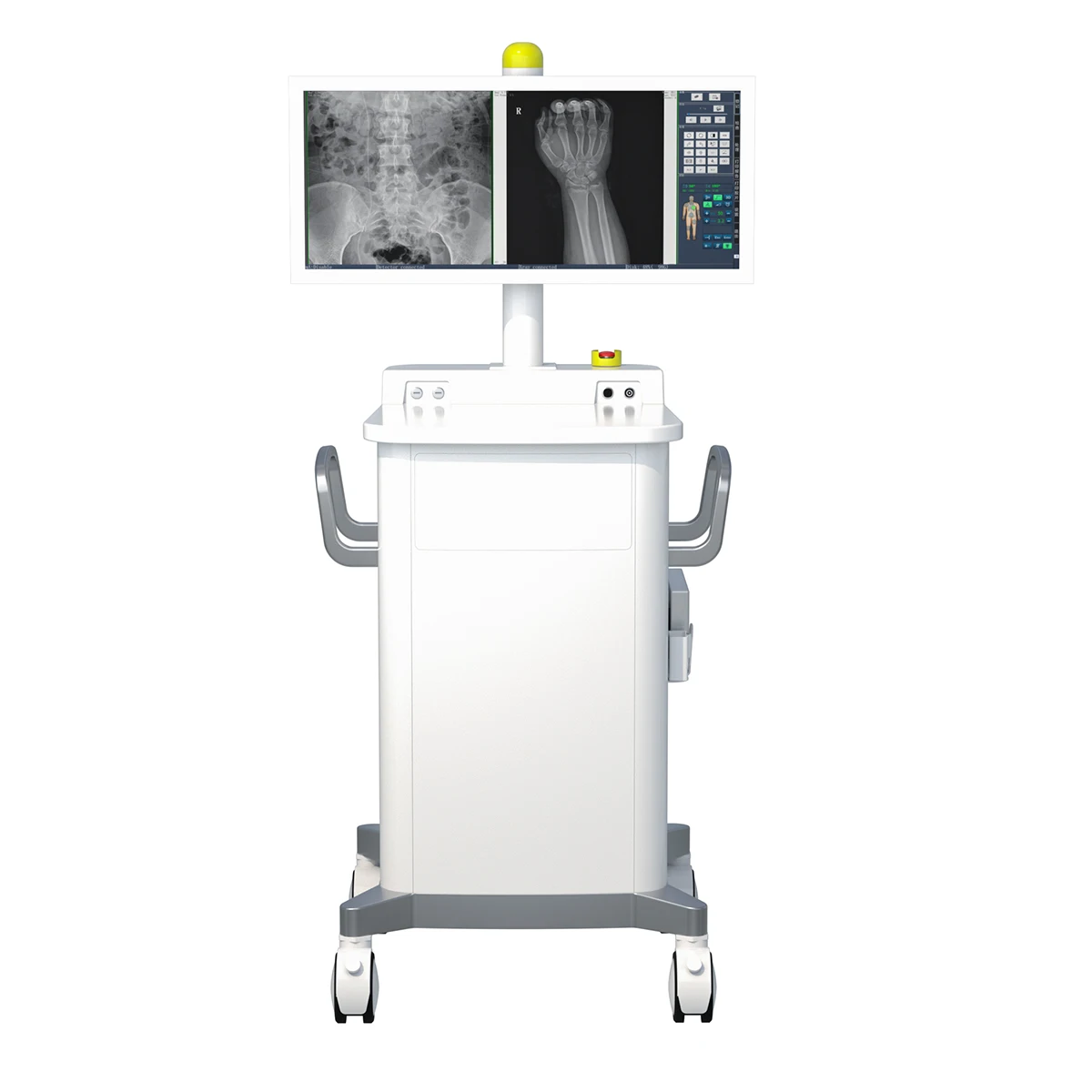 Medical Mobile 5kW HF Digital 3D C arm X Ray Machine for Orthopedics Surgery