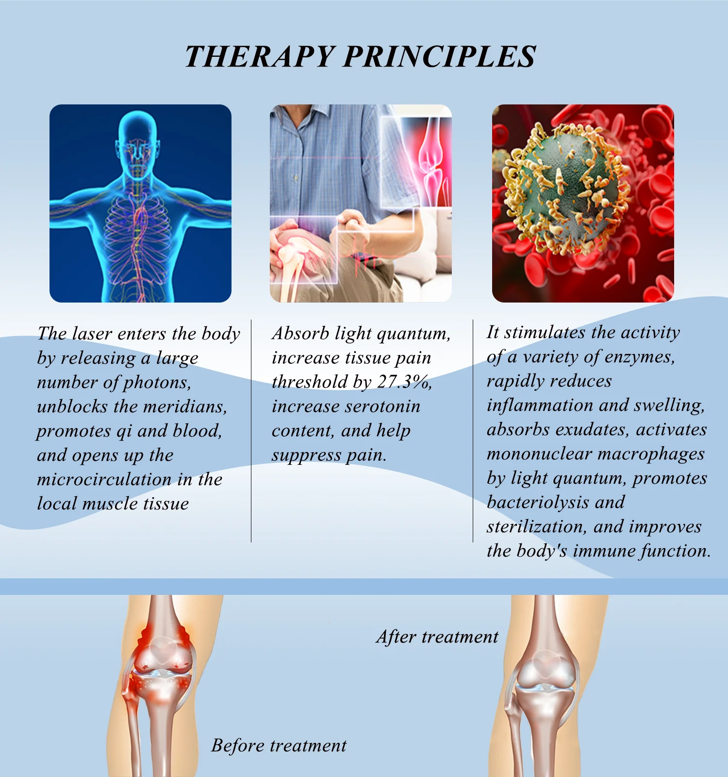 New Design Laser Acupuncture Medical for Joints Inflammation Sports Injury Mastitis Prostatitis Therapy Device
