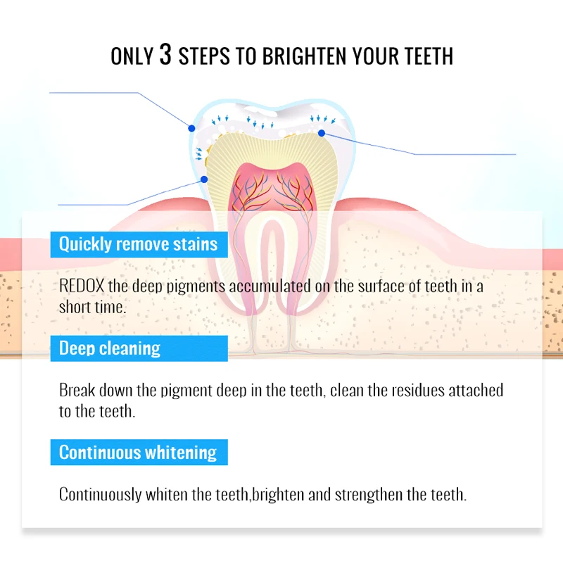 OMY LADY  March Expo 2022 Hot Selling  Teeth Whitening in Office and Brightenning Magic Non-toxic Teeth Whitening