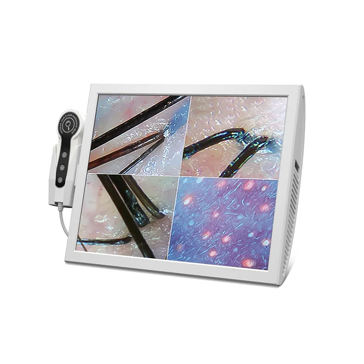 Wholesale price 15 Inch Digital HD Screen Home Use Skin And Scalp Hair Analyzer