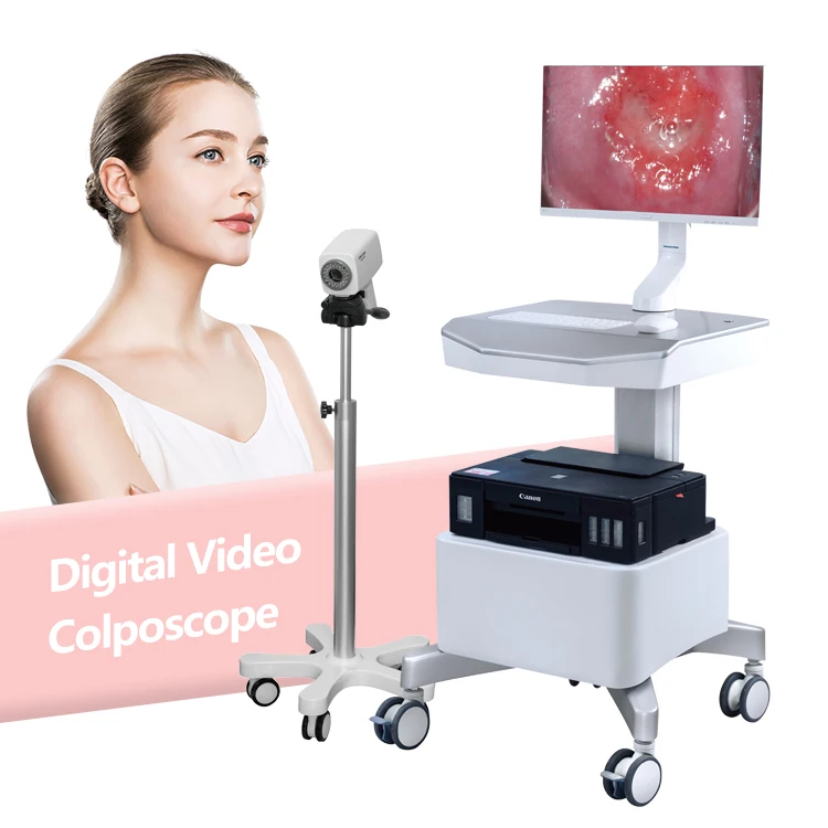 Colposcopio Digital Colposcope Cervical Disease Examination Colposcopy for Gynecology SONY Camera Video