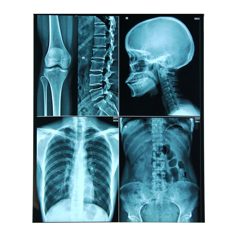 PET base blue sensitive medical dry film for hospital radiography department