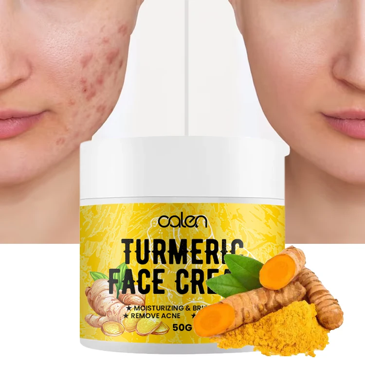 Oalen Private Label High Quality Skin Care Anti Aging Moisturizing Whitening Reduce Acne Face Cream Turmeric Cream