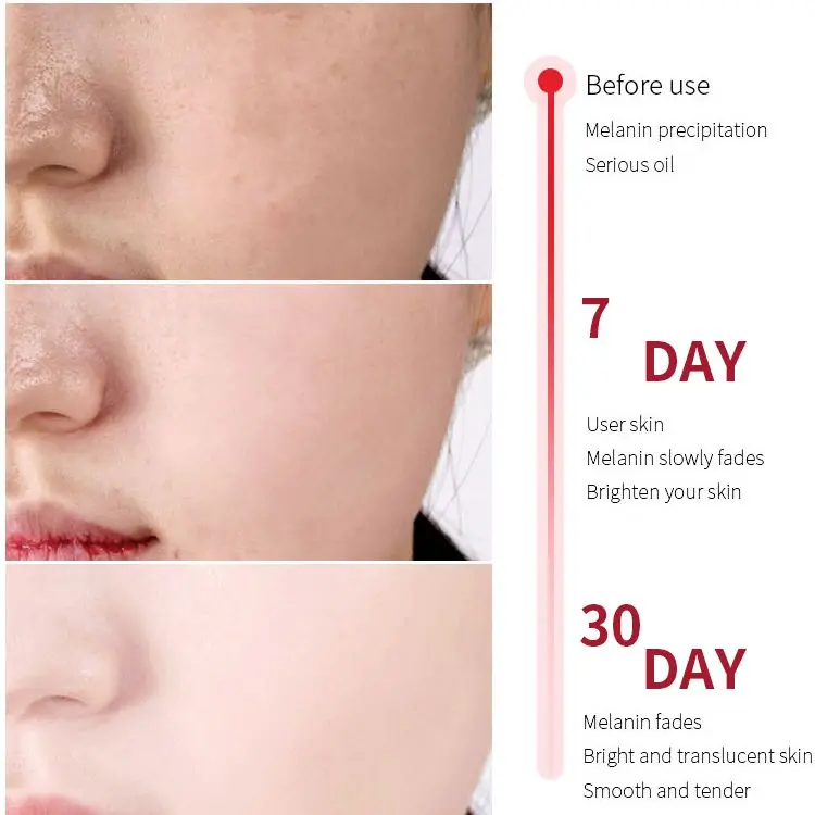 Private Label Pure 100% Skin Fade Spot Whitening Alpha Arbutin Serum