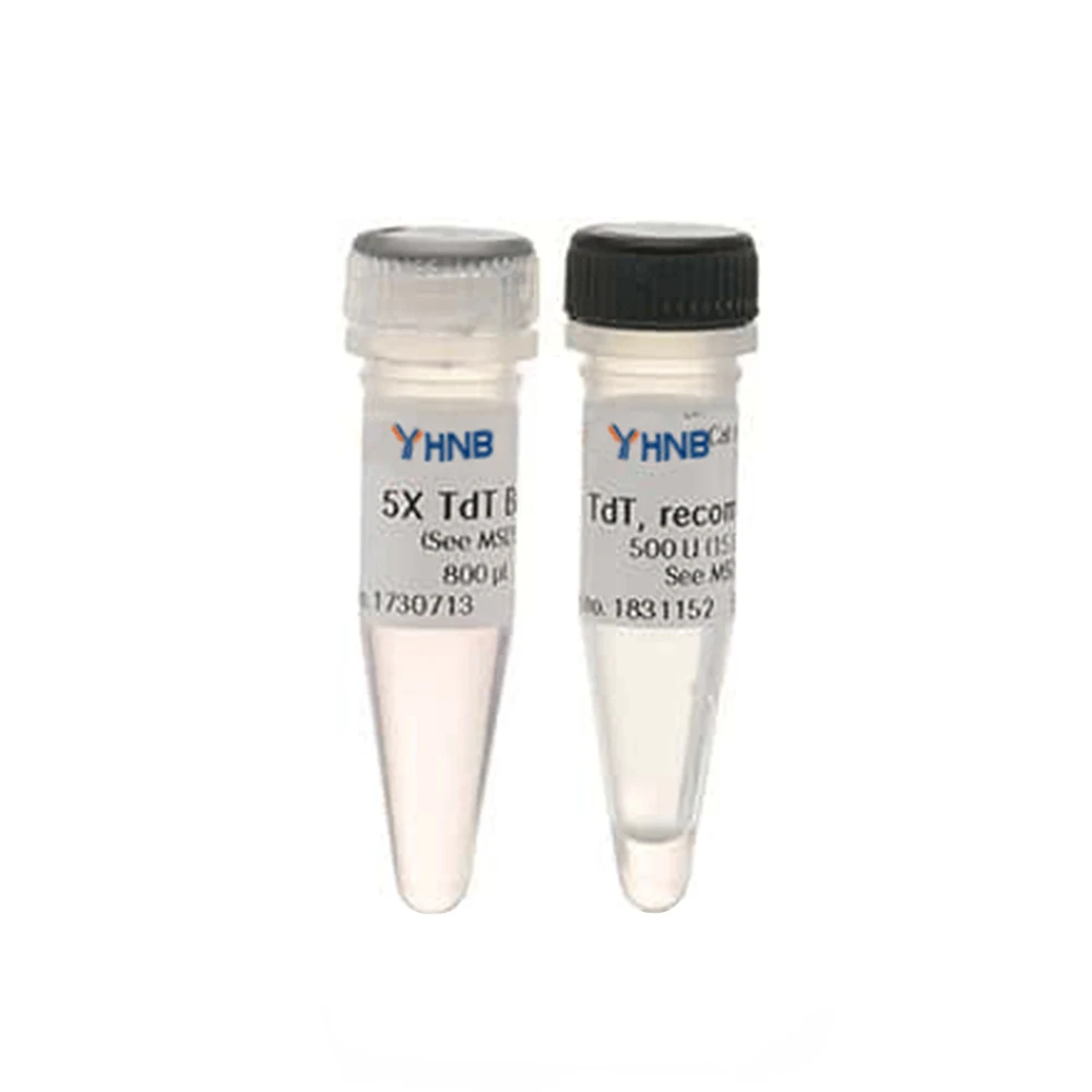 IVD Kit Raw Materials Recombinant Protein IVD Reagent high sensitivity Recombinant measles virus antigen Recombinant Mev NP