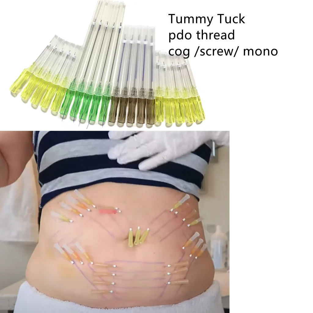 cog 4d 3d 6d 8d  21g100mm for jawline face lift pdo thread korea with cheap price