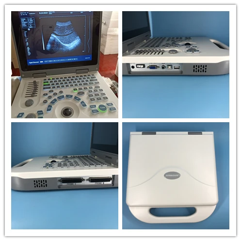 CE medical laptop ultrasound machine professional JM-806G vascular ultrasound China best manufacturer