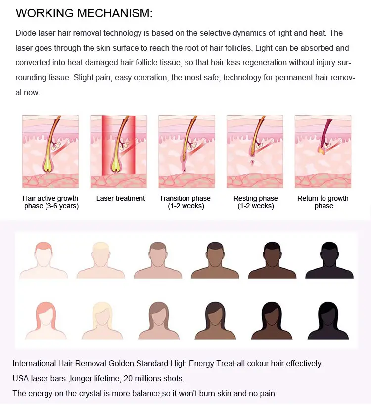 Alma device for laser hair removal 2022 high quality laser hair removal machine 1600w diode laser hair removal machine lebanon