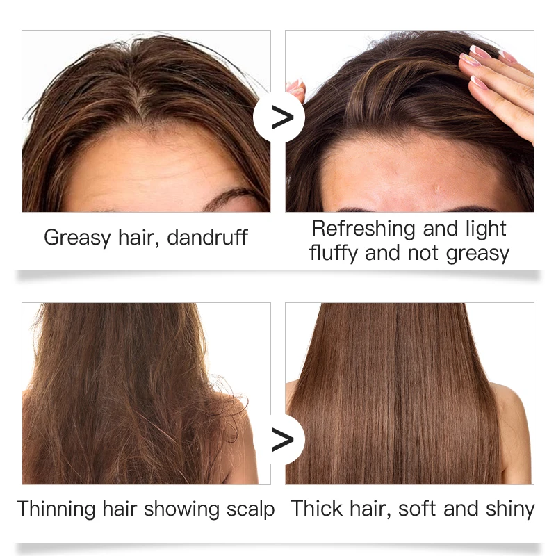 Ginger organic hair loss Shampoo Private Label Natural Organic For Hair growth Ginger Shampoo