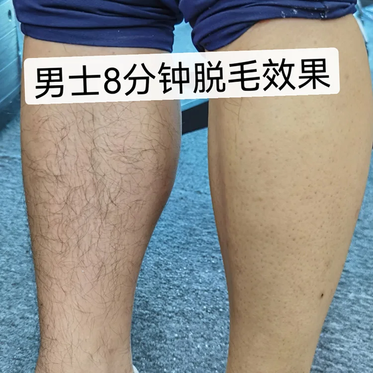 Convenient Effective Chemical Hair Removal Mousse Cream Hair Removal Spray