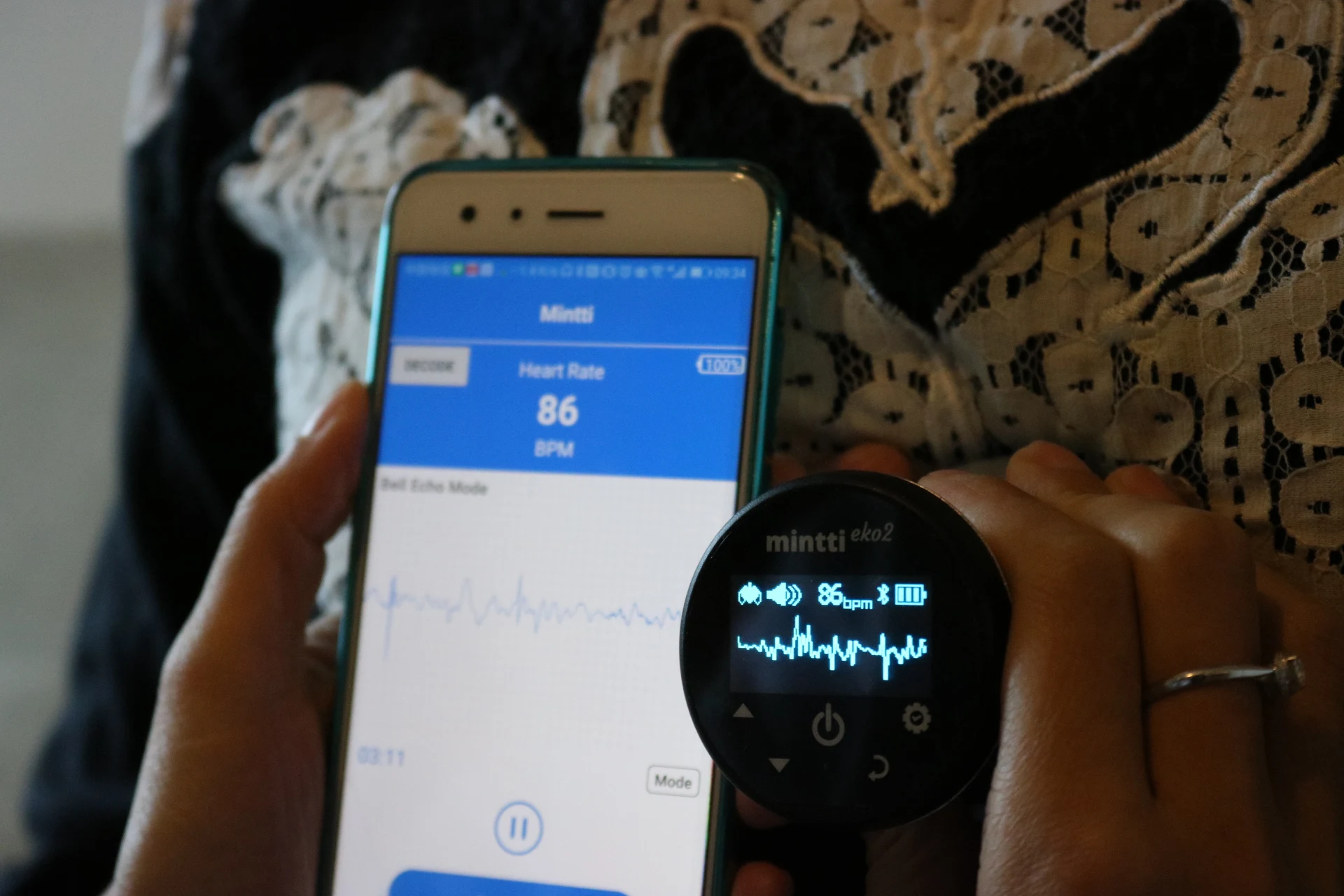 Intelligent Digital Patience Stethoscope Monitoring for Telemedicine and Telehealth