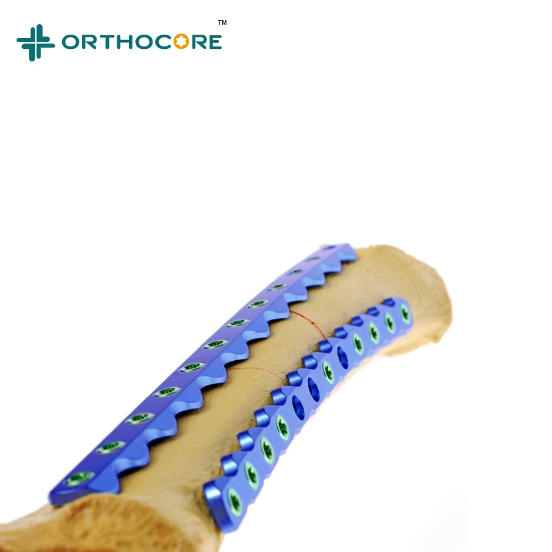 Усовершенствованная система блокировки ALP 10 мм 11,5 мм ветеринарные Ортопедические Хирургические инструменты для животных