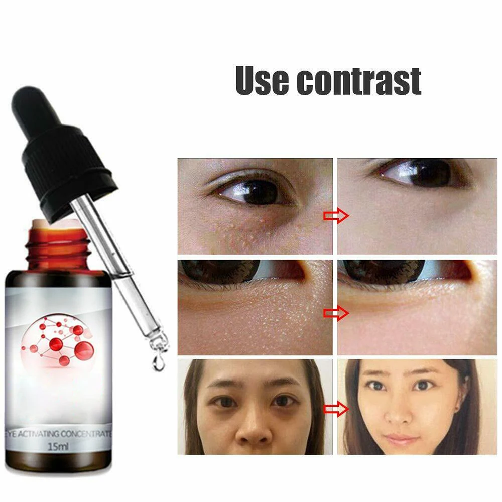 OEM ODM Supply Anti Wrinkle Dark Circles Puffiness Eye Serum For Cosmetic