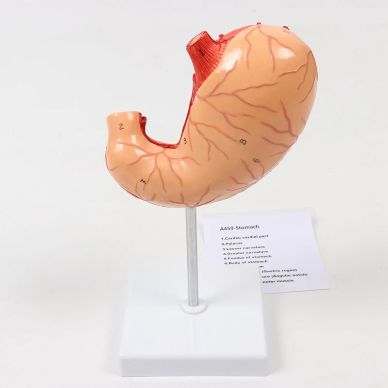 Medical Science Human Digestive System Pathological Stomach Anatomy Model For Education