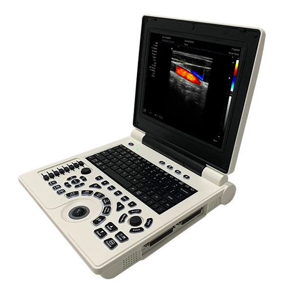 C2 CHEAP COLOR DOPPLER Portable Ultrasound Machine 24 Channel