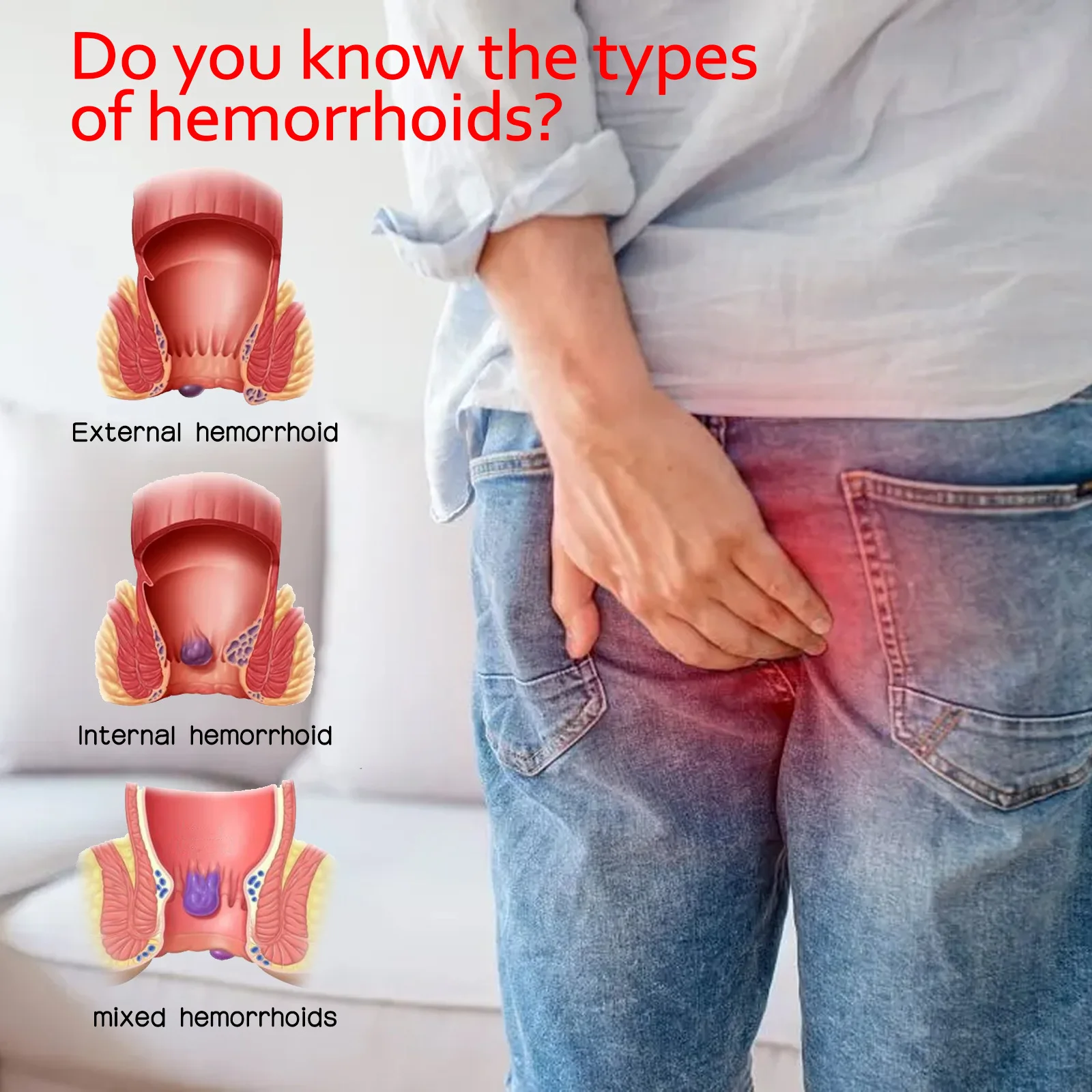 Hot Selling South Moon Brand Hemorrhoids Cream Chinese Traditional Herbal Extracts Hemorrhoids Ointment