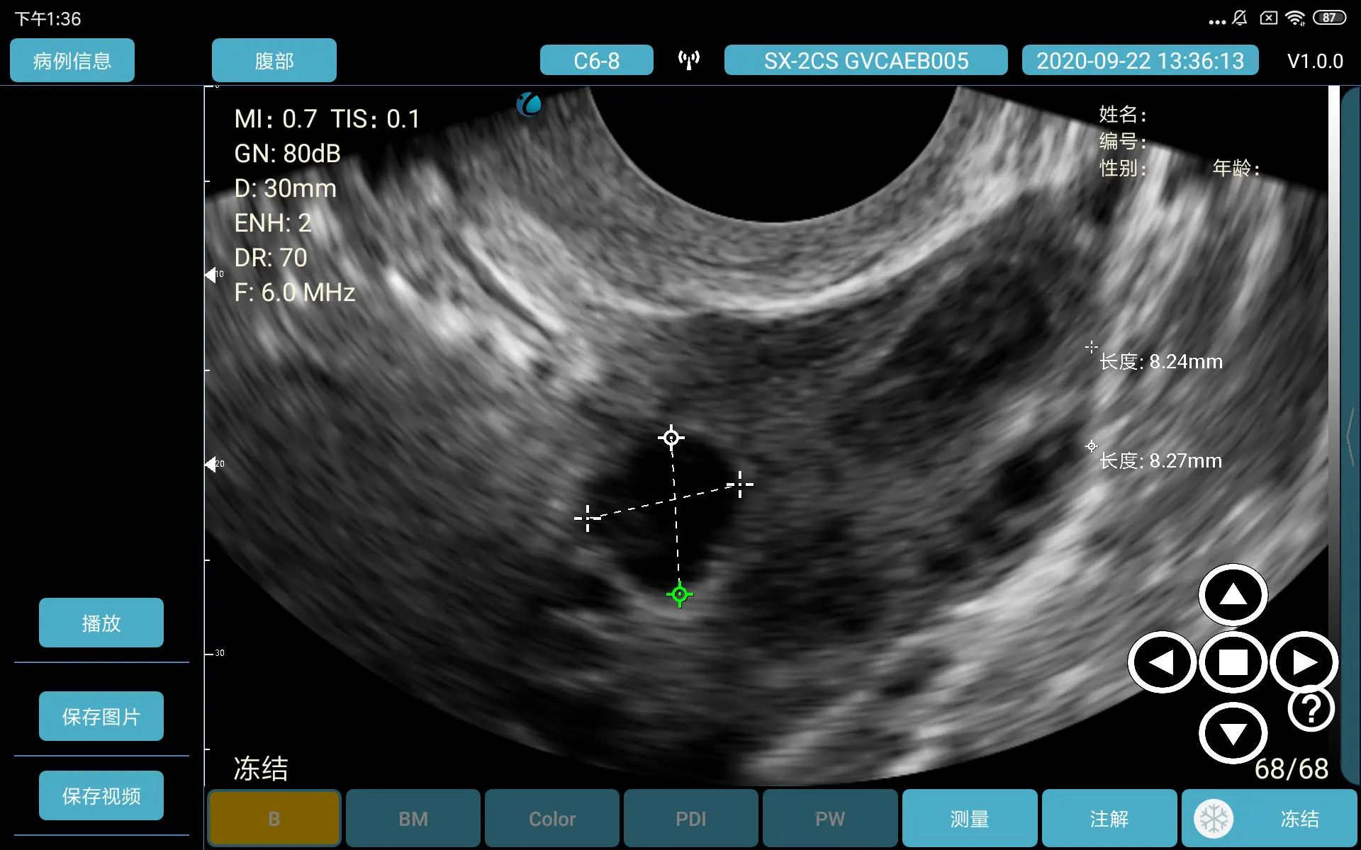 convex and micro convex wireless handheld ultrasound portable for vaginal gyn devices ultrasound portable with low price