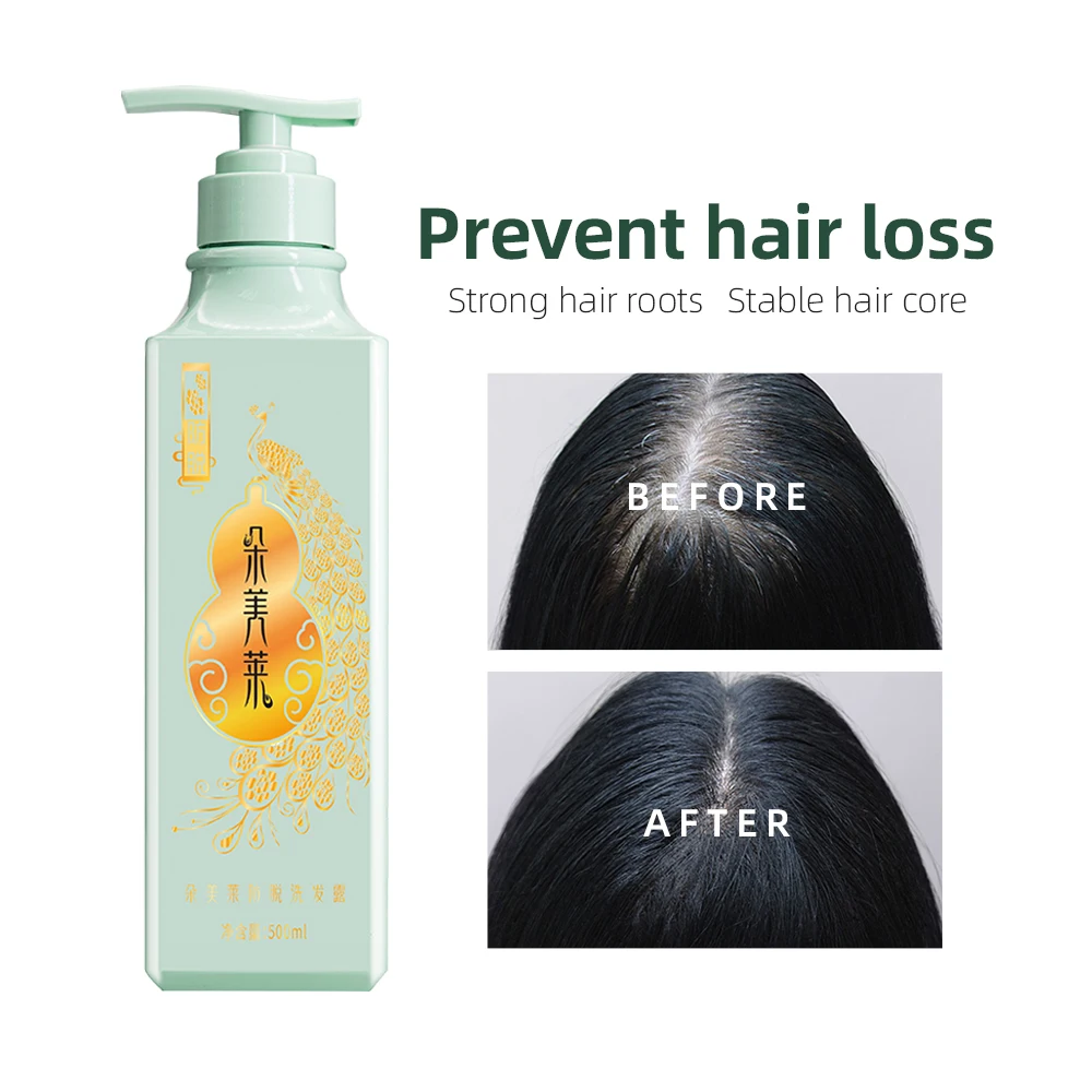 Domelay Luxury Organic Sulfate Free Restore Shampoo Custom Hair Growth Shampoo