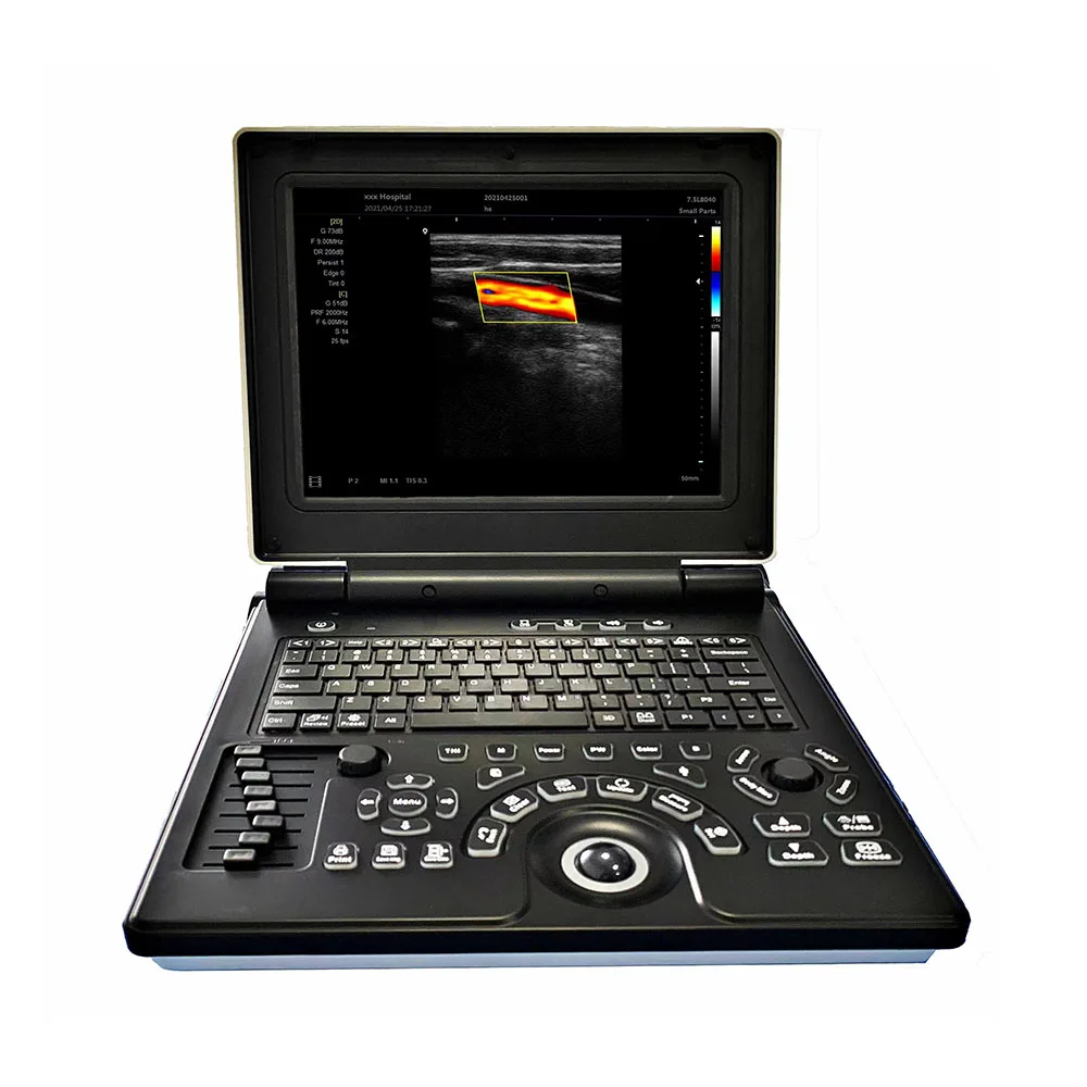 Hot Sale Portable color doppler  Ultrasound Machine With 3d software
