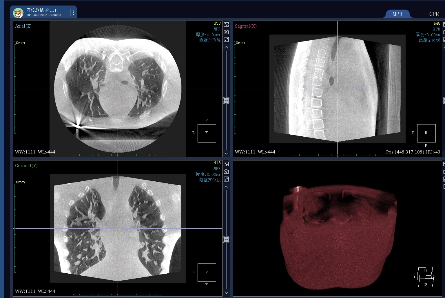 EUR PET 16 32 64 128 Slice Computed Tomography Scanner Medical Ct Scan Machine