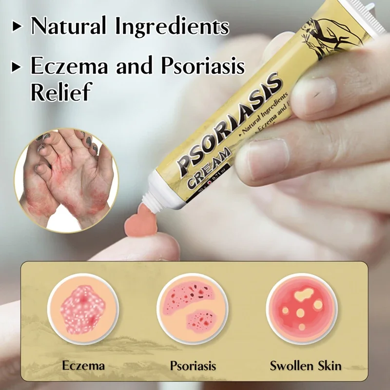 hot selling fungal infection skin psoriasis cream dermatitis eczema ointment treatment psoriasis cream skin cream
