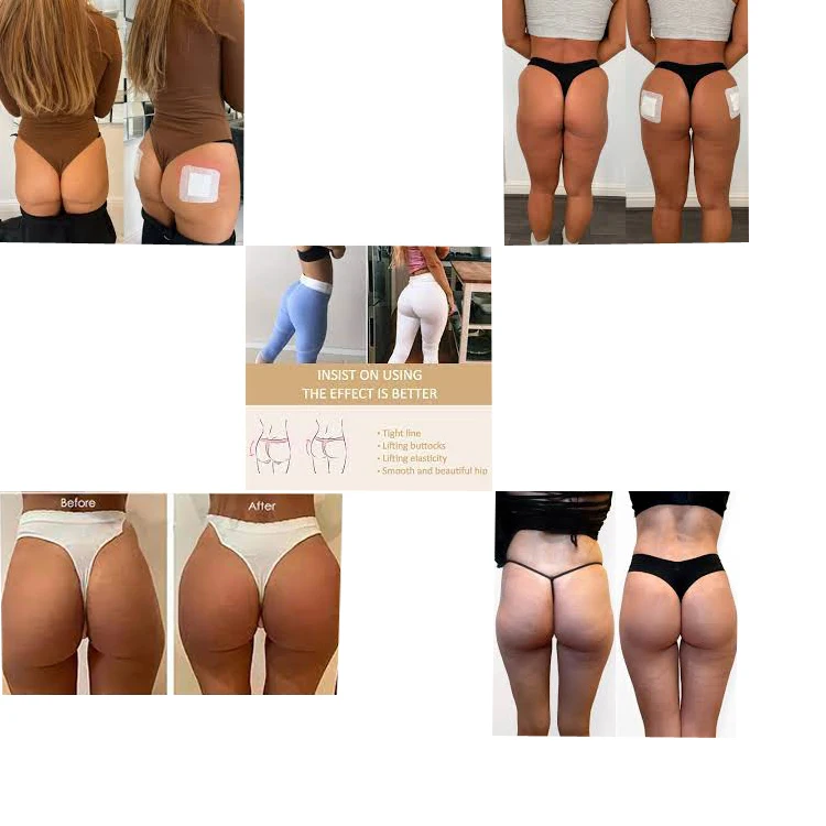 Wholesale price Korean Male Penis  Implants Enlarging penile  Syringe Hyaluronic Acid Injection Enlargement Of penis