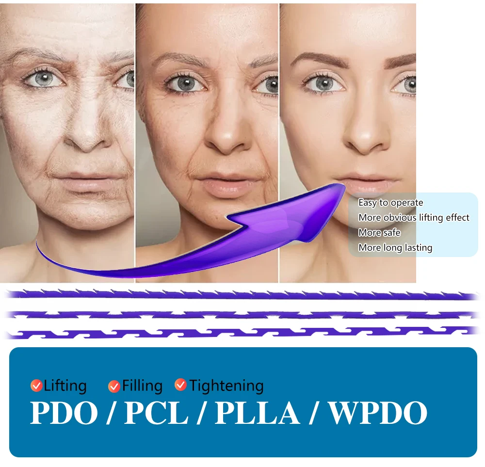 Korea 19G 410mm Facial Aesthetics Use Double Needle Korea Pdo Thread For Lifting