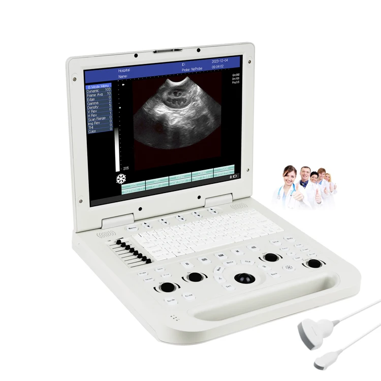 Portable B/W Mode Ultrasound Machine LED Digital Convex Linear Probe Durable Metal Plastic Design Hospital Electric