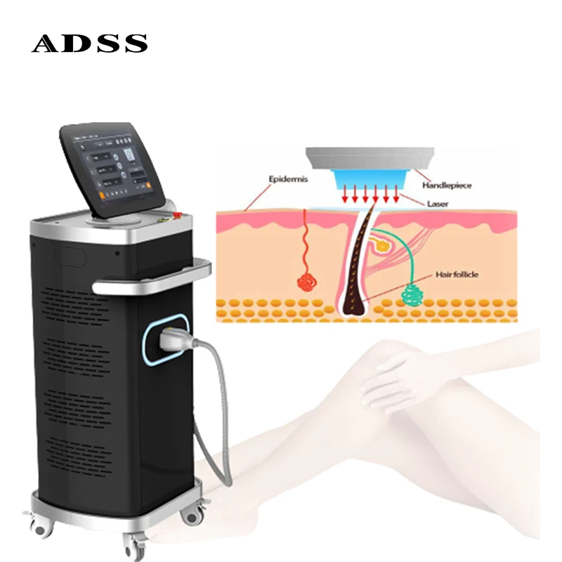 ADSS professional vertical diode laser /755+808+1064 laser hair removal machine