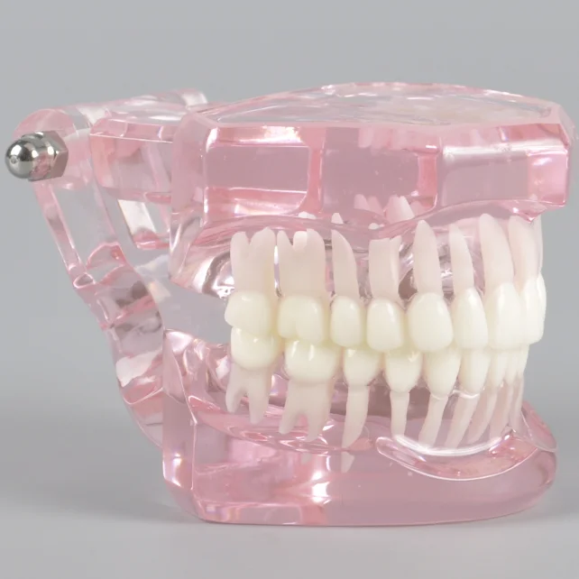 Новая модная Стоматологическая прозрачная модель, ортодонтика без кронштейнов