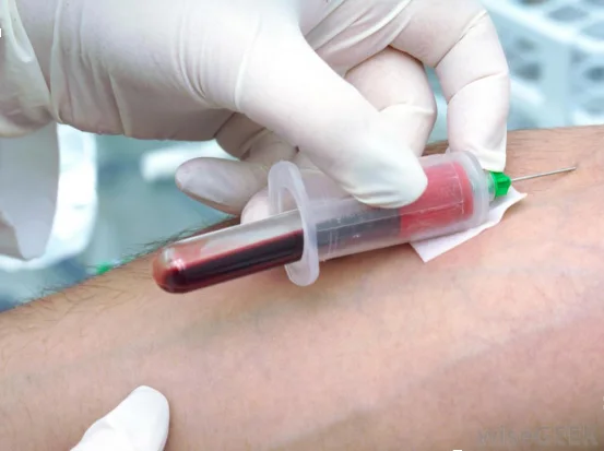 JUNNUO Vacuum Blood Collection Tubes OEM Glass Storage Instrument PET Class/ESR/Sampling/