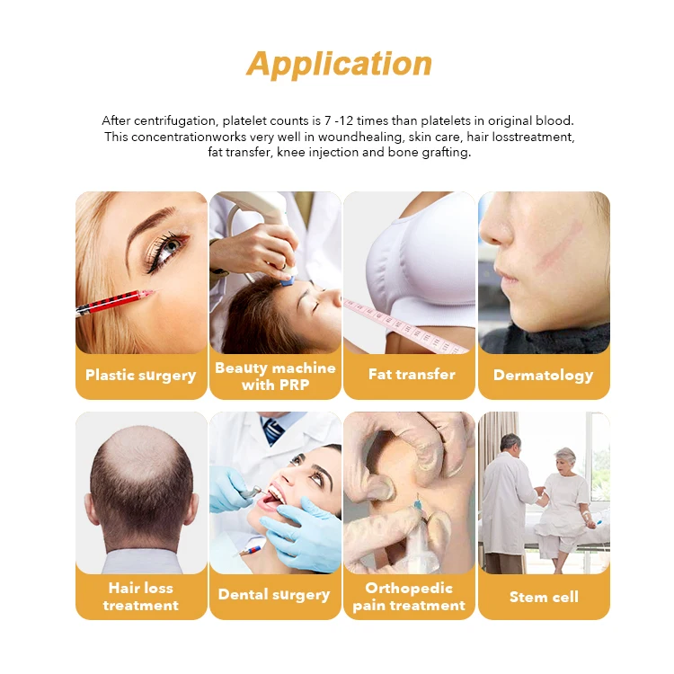 MANSON Platelet Rich Plasma PRP Tube with Acd Gel for Sale