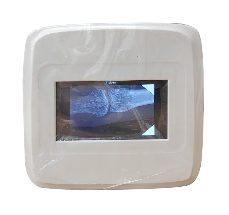 Factory Price High-definition Dental X-Ray Machine Portable With Touch Screen