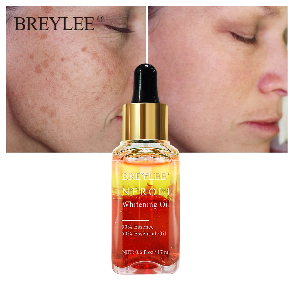 Breylee whitening removal spot  Essential Oil and  Vitamin C Essence face serum
