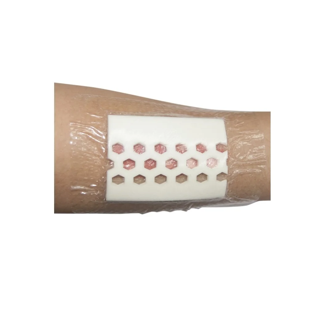 Yafho Foam Dressing - Foam Dressing Wound Visible