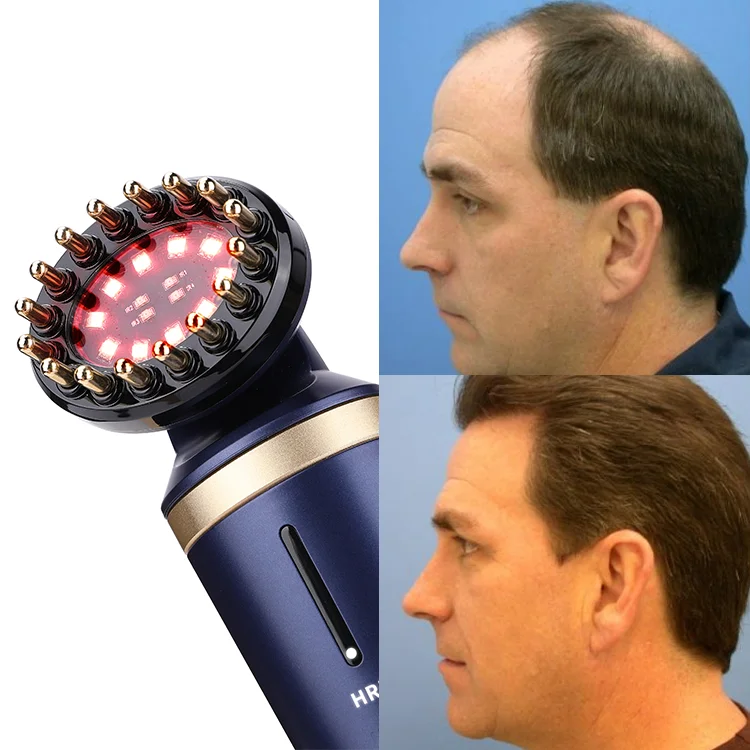 Free Sample Quick Custom Label Laser Ionic Styling Brush Infrared Health Therapy Hair Growth Machine Comb