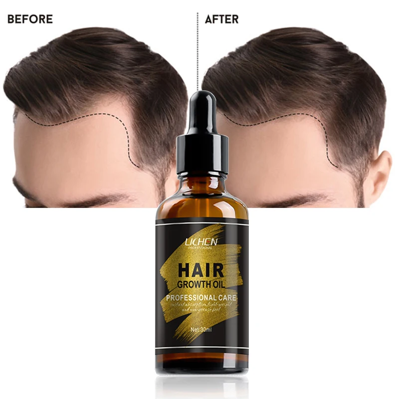 Best bulk extra strength scented all natural herbal hair growth oil alopecia castor oil for hair growth