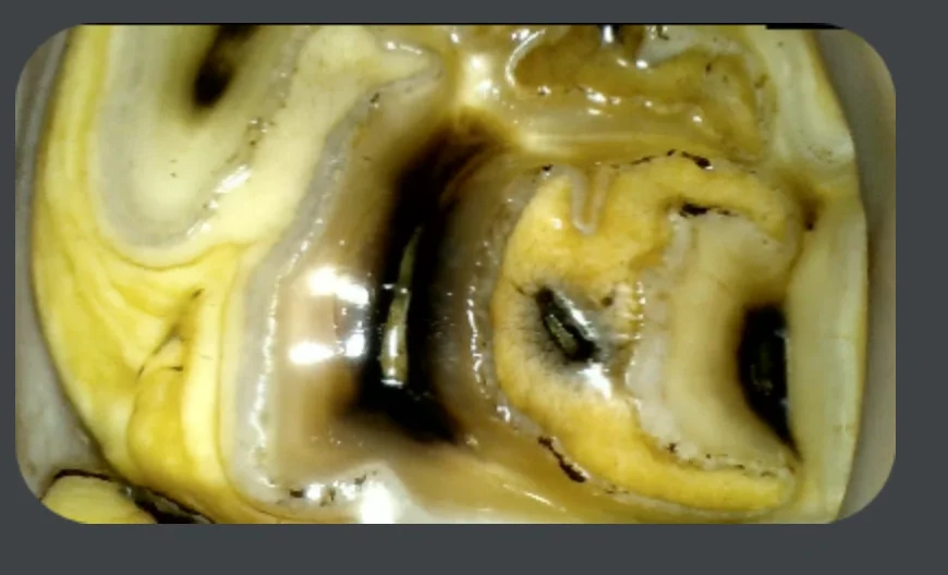 YD-UE100 Digital HD oral endoscope USB VIDEOSCOPE Horse dental examination equine dental equipment equine veterina