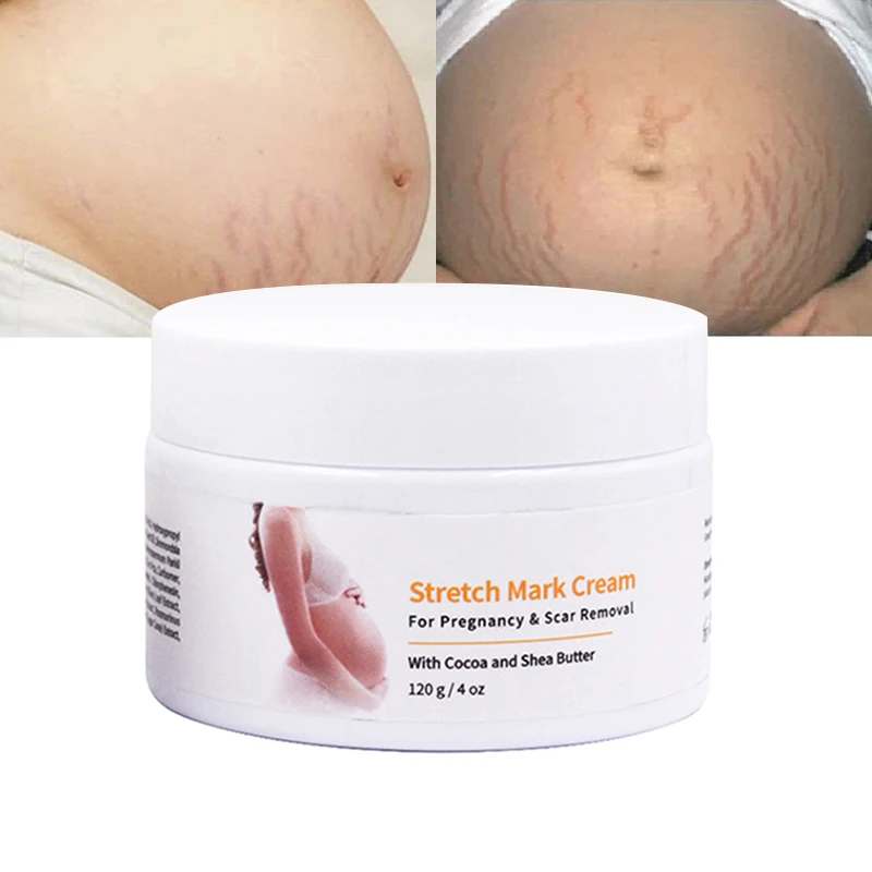 private label effective stretch mark organic removal cream mango pregnancy for marks anti repair stretch mark cream