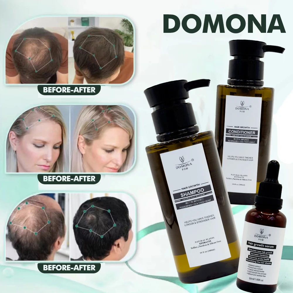 Popular Hair Growth Set Products Rosemary Castor Oil Anti Hair Fall Control Ginger Shampoo & Conditioner & Herbal Essence Oil