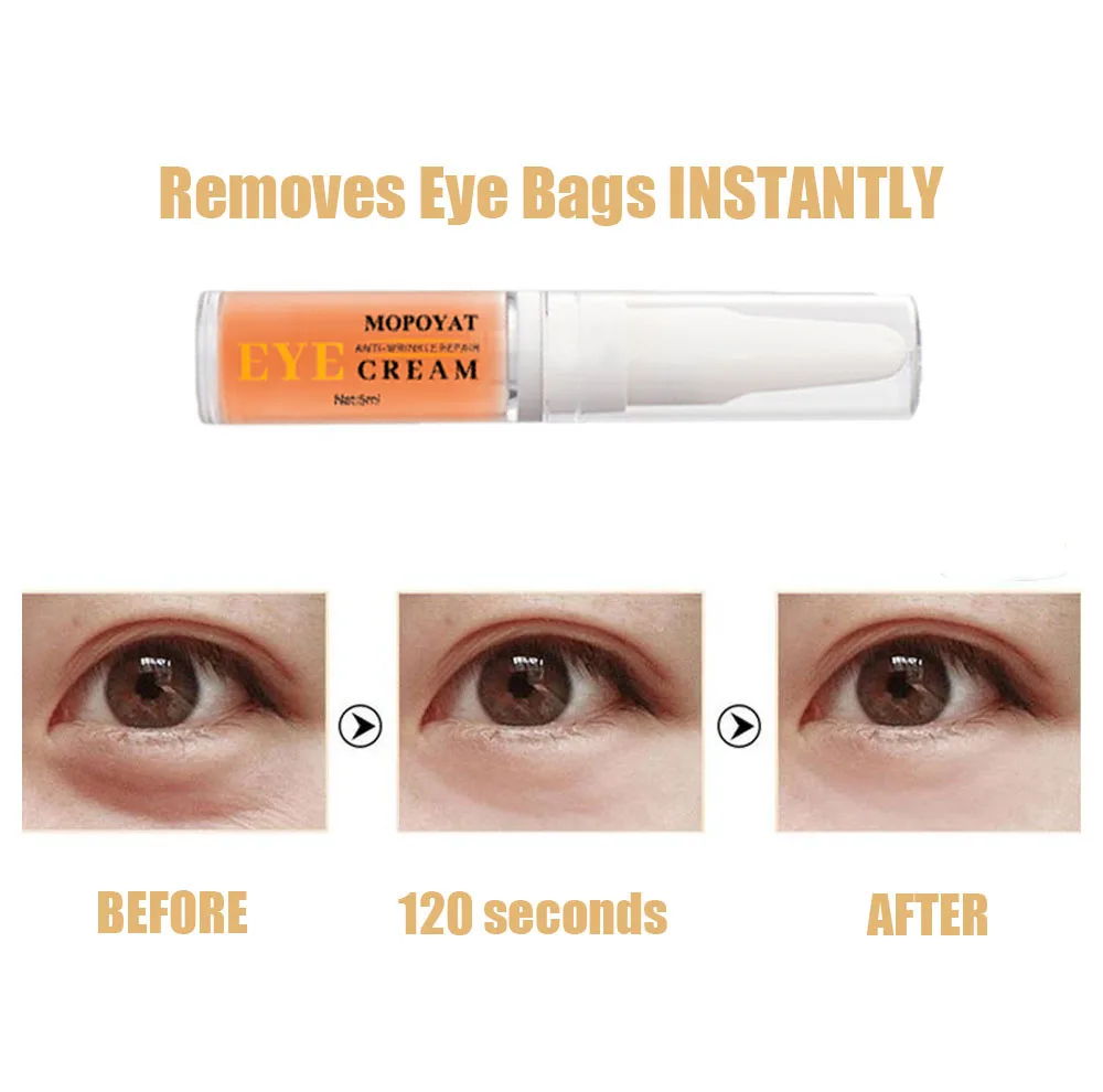 
Anti-puffiness Remove Dark Circles Eye Bag Removal Cream Ageless Firming Under Eye Repair Cream Tube Anti Wrinkles 