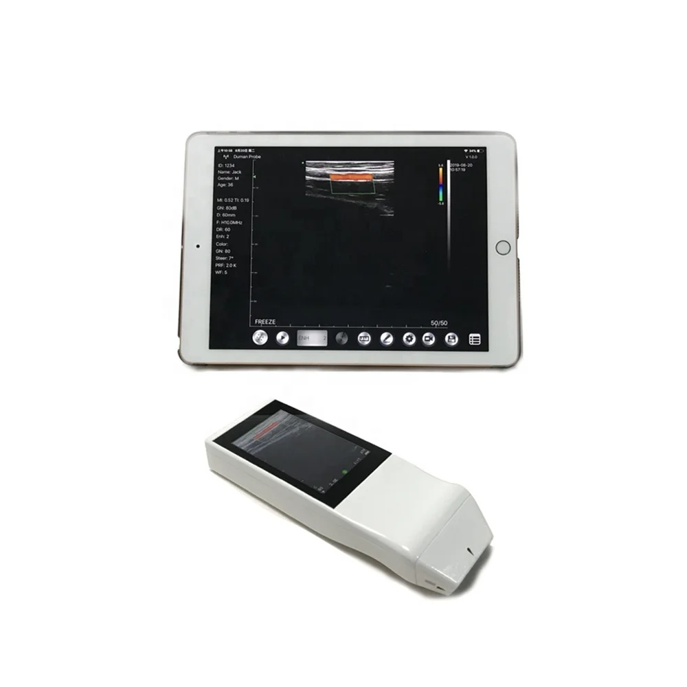 3 Inch Waterproof Handhlld Wireless Color Doppler Ultrasound Scanner WiFi Linear Probe