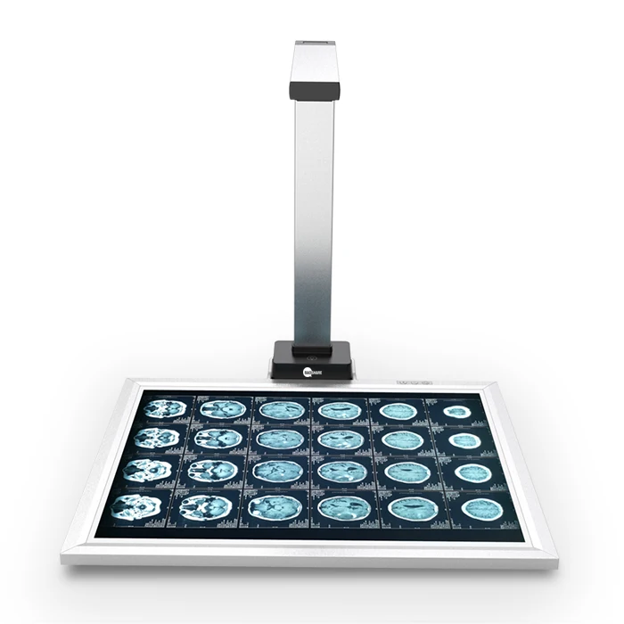 18MP  X ray Film Scanner with light box