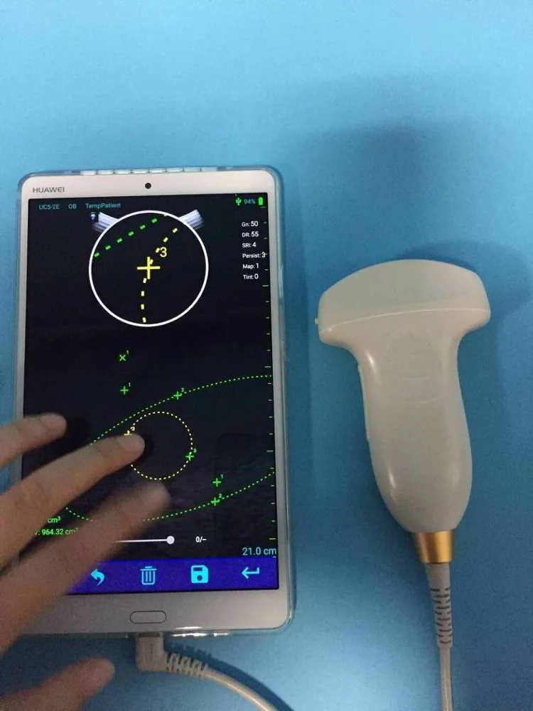 SUN-P1 ultrasound machine display USB convex probe smart phone computer convex probe price