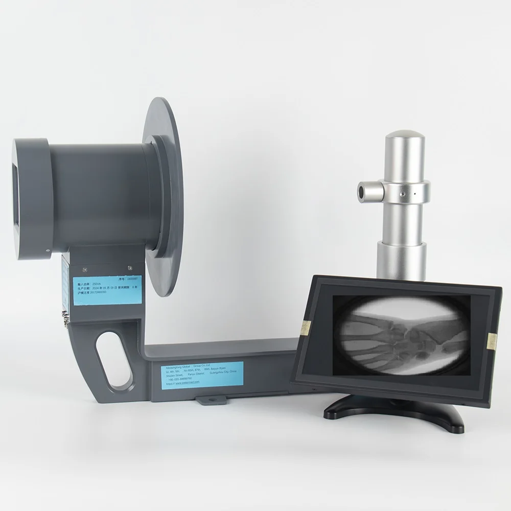 NEW handheld medical Fluoroscopic X-ray machine Portable X ray Fluoroscope fluoroscopy